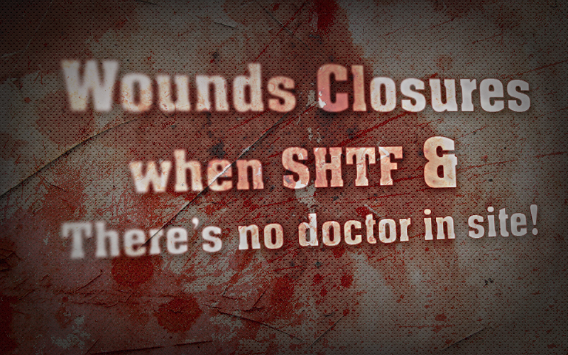 Wounds-closures-when-SHTF-and-theres-no-doctor-in-site