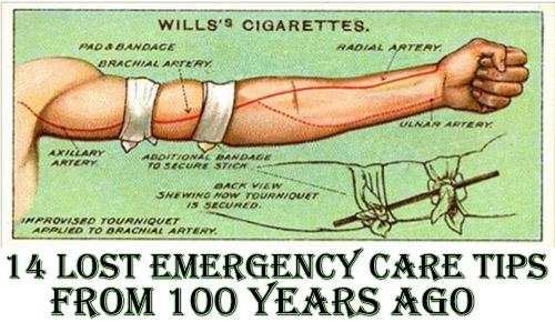 14 Lost Emergency Care Tips From 100 Years Ago